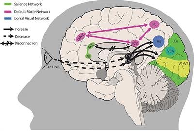 Imaging the Visual Network in the Migraine Spectrum